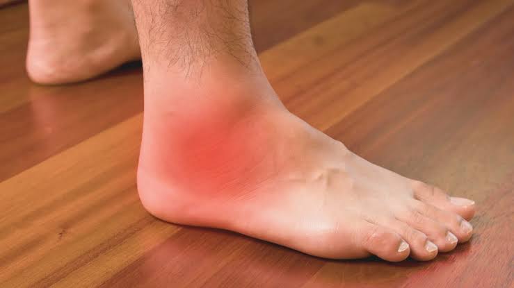 Những việc không nên làm khi bị lật sơ mi